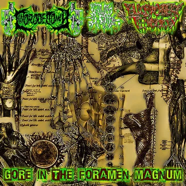 Gore In the Foramen Magnum
