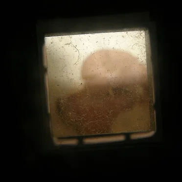 Through a pinhole: an ear, a nose, a throat