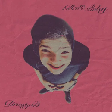 Bell's Palsy