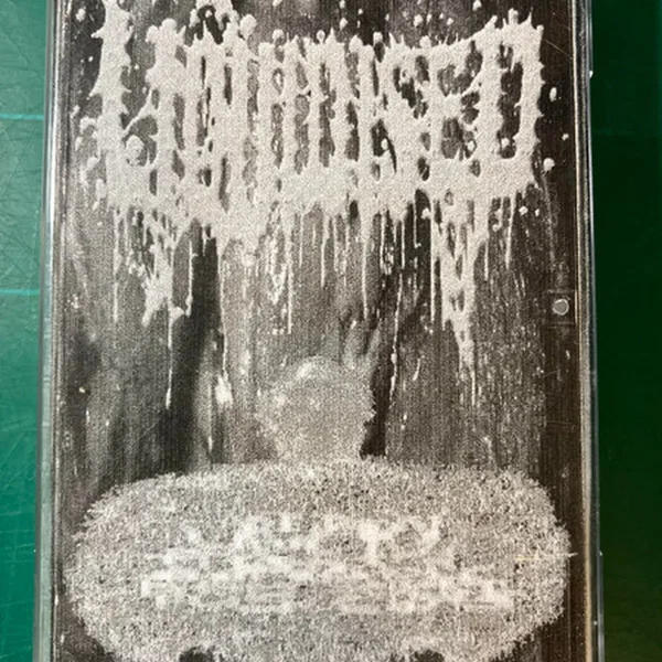 Liquidised / Urinary Tract Infection From Severe Pus Clots