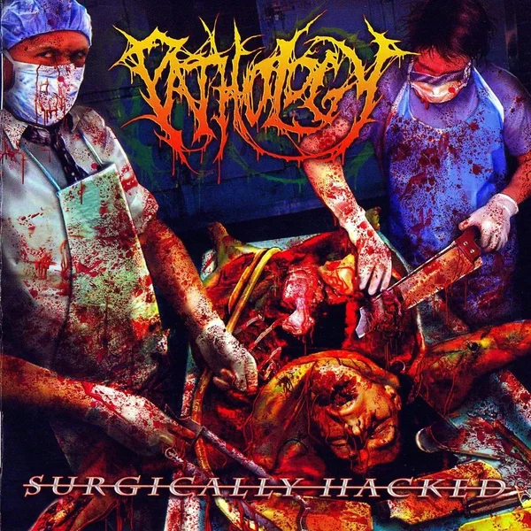 Surgically Hacked