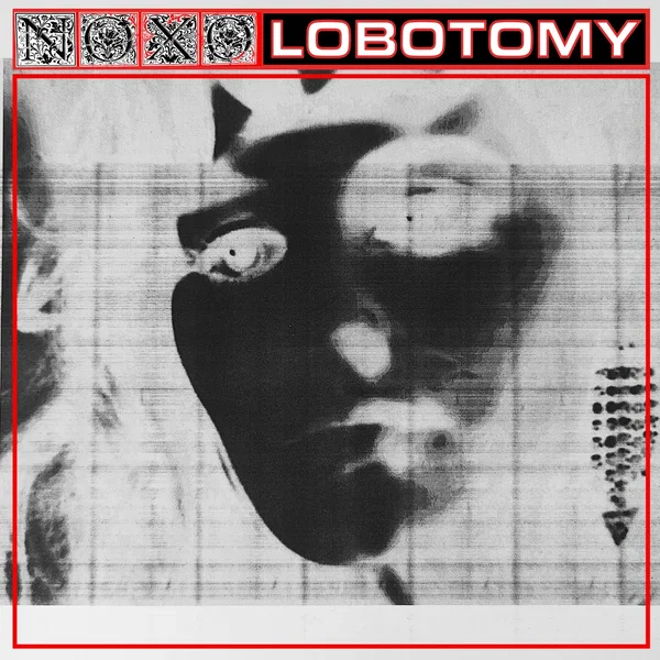LOBOTOMY