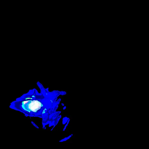 [blank]