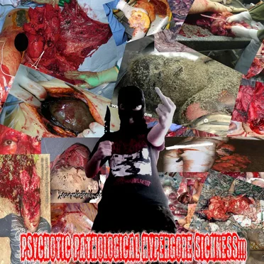 Psychotic Pathological Hypergore Sickness!! by Various Artists - album cover