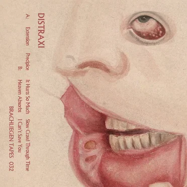 Distraxi