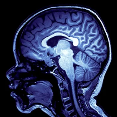 Minds Taken