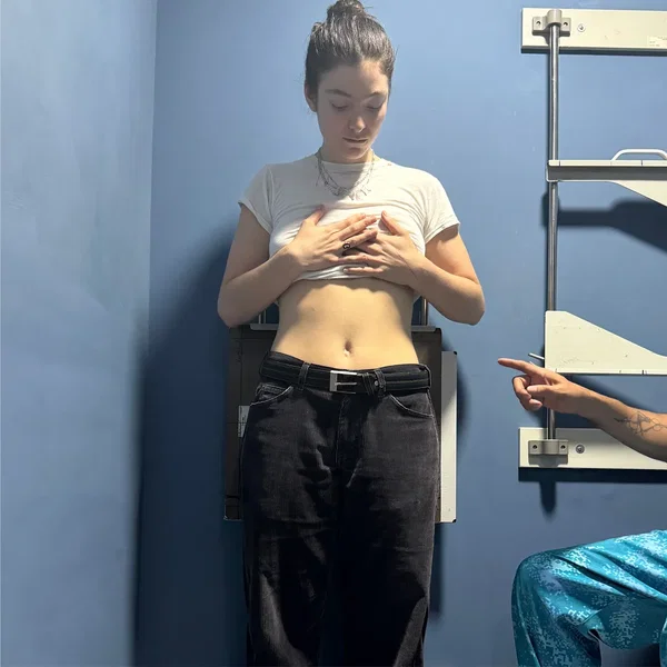 XRAYS
