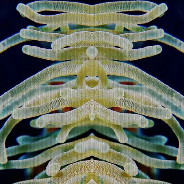Coral de oro