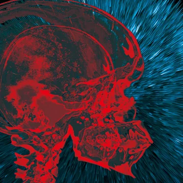 Altered Brain Data Explosion