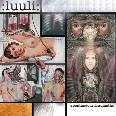 Spontaneous Traumatic