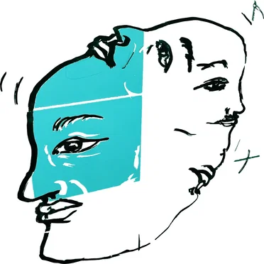 Supratemporal Dissociations
