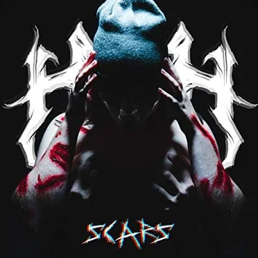 Scars