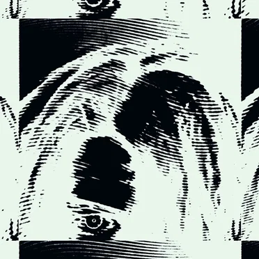 b̷rokecœur;arrhythmia