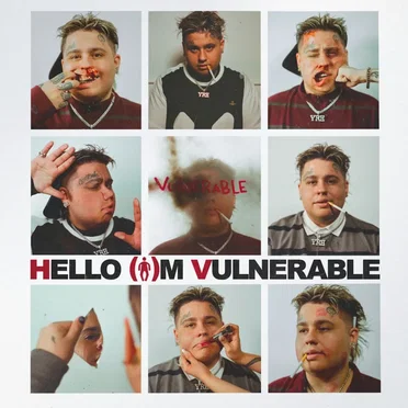 Hello I'm Vulnerable