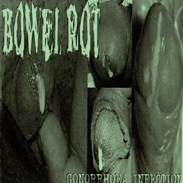 Gonorrhoea Infection