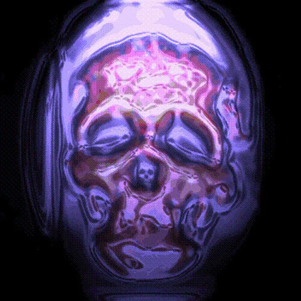 Mind Control
