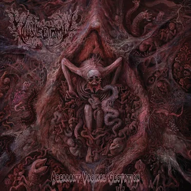 Aberrant Vaginal Gestation by Vulvectomy - album cover
