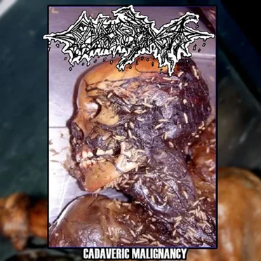 Cadaveric Malignacy by Endopraxis - album cover