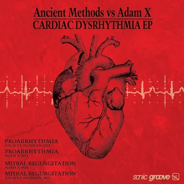 Cardiac Dysrhythmia EP