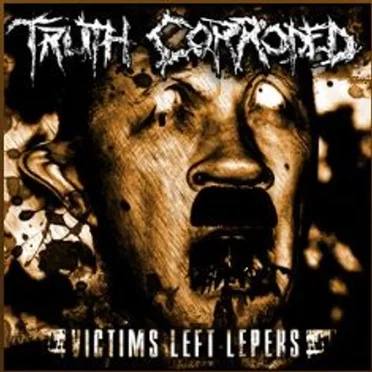 Victims Left Lepers