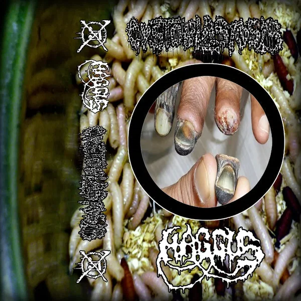 Haggus / Cystoblastosis