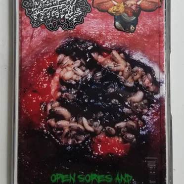 Open Sores And Infected Appendages