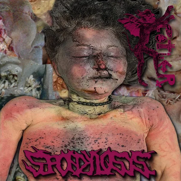 Vomissant