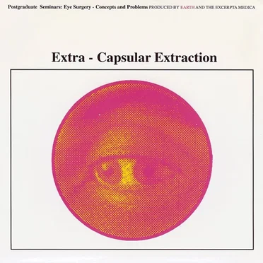 Extra‐Capsular Extraction