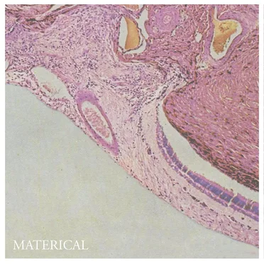 Materical by Materical - album cover