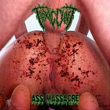 ASS MASSACRE