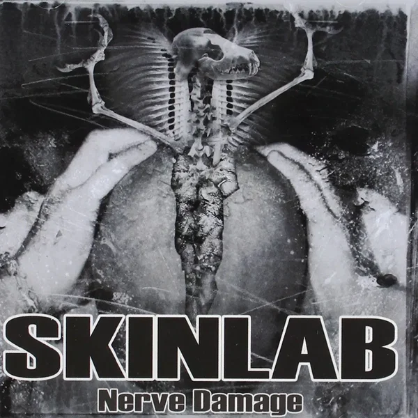 Nerve Damage