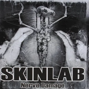Nerve Damage