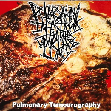 Pulmonary Tumourography by Pulmonary Infections in the Cancerous Lung - album cover