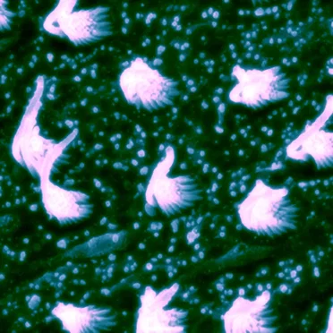 Evoking Potentials