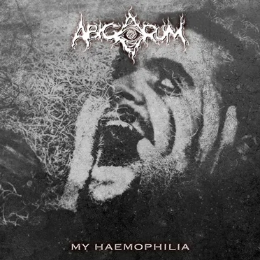 My Haemophilia