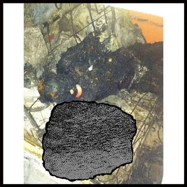 ASPHYXIATION VIA HUMAN EXCREMENT by Cyclosporiasis - album cover