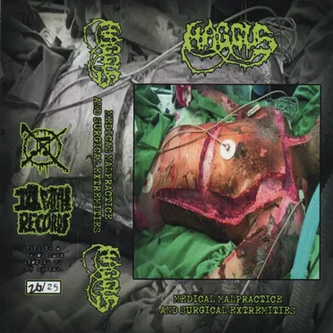 Medical Malpractice and Surgical Extremities