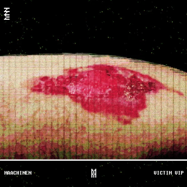 VICTIM (VIP mix)