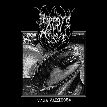 Vasa Varicosa