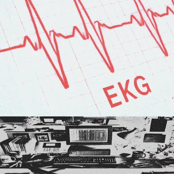 EKG
