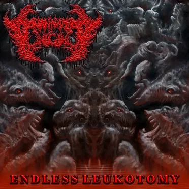 Endless Leukotomy