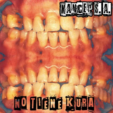 No tiene kura