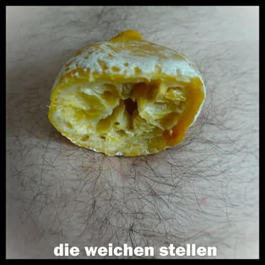 die weichen stellen