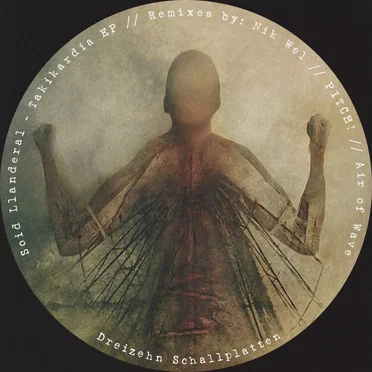 Takikardia EP