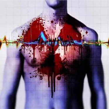 Arrhythmia by [N]egative01 - album cover