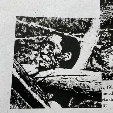 Severed Head Placed On A Barbed Wire Barricade With A Cigarette Butt Placed Between It’s Lips