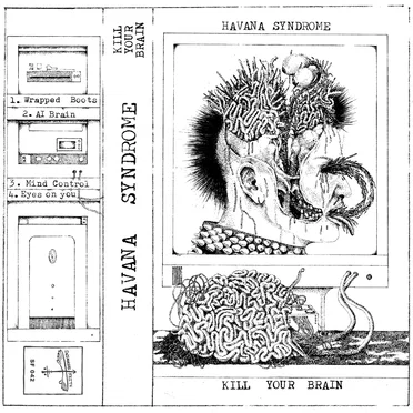Havana Syndrome