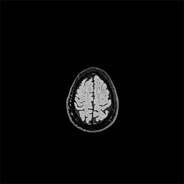 Obstinado EP