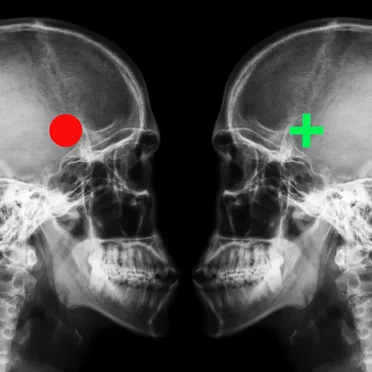 Shock the Monkey (Earth Day version)