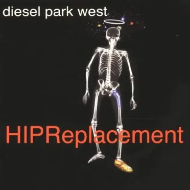 Hip Replacement